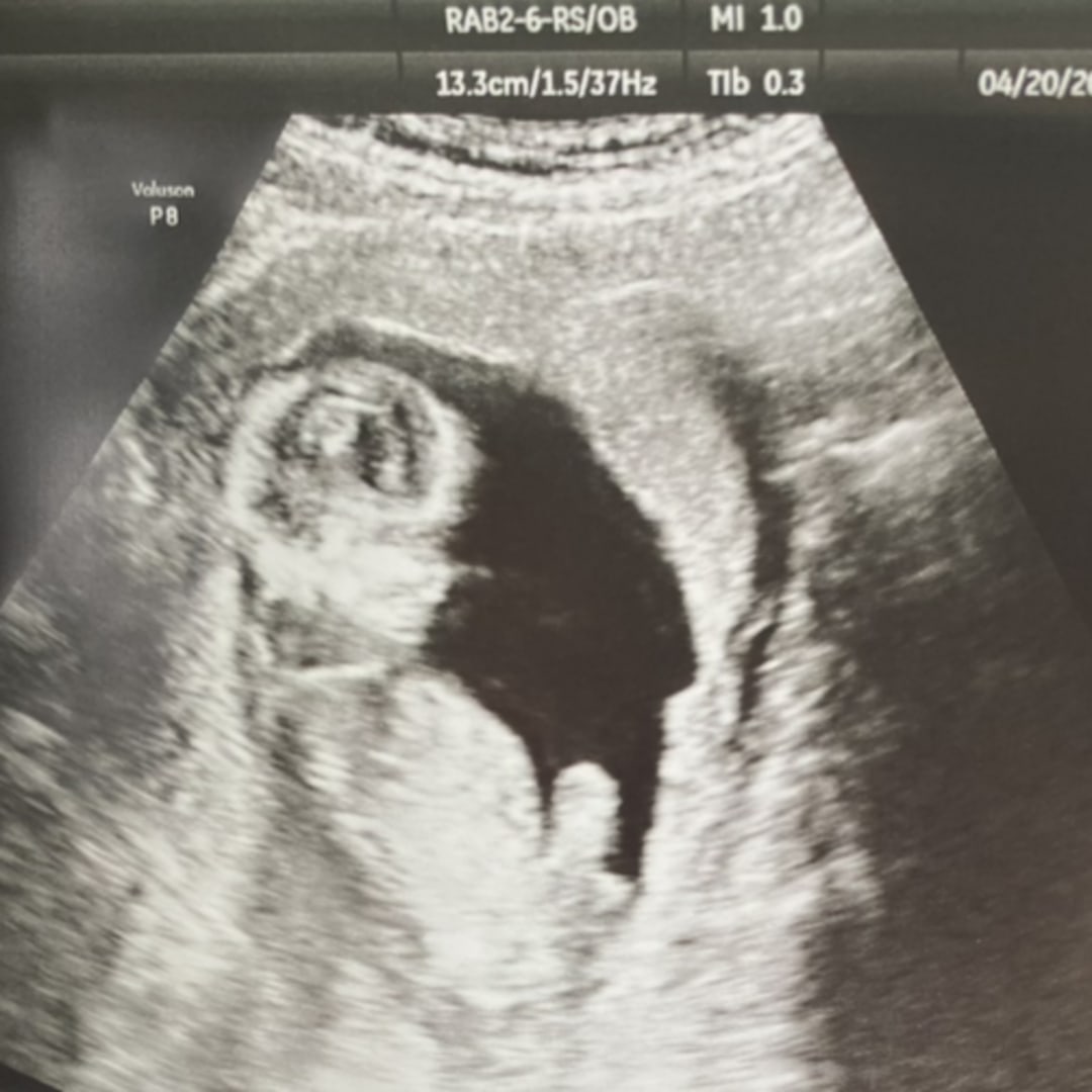 Photo shared by Jessica for their Babylist baby registry.