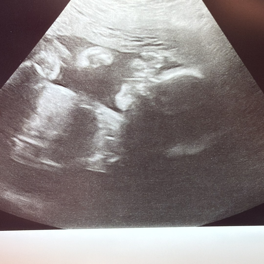 Photo shared by Sonia for their Babylist baby registry.