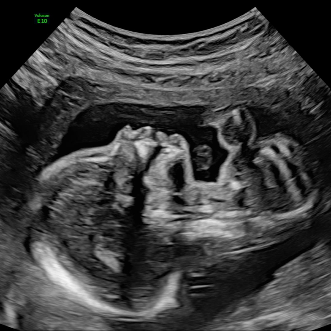Photo shared by Brittni for their Babylist baby registry.