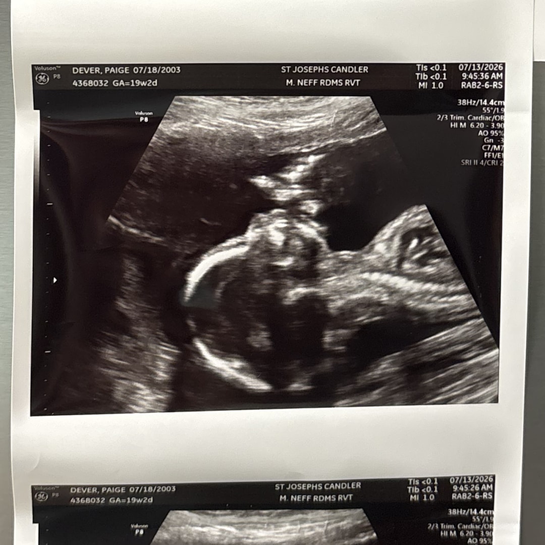 Photo shared by Paige for their Babylist baby registry.