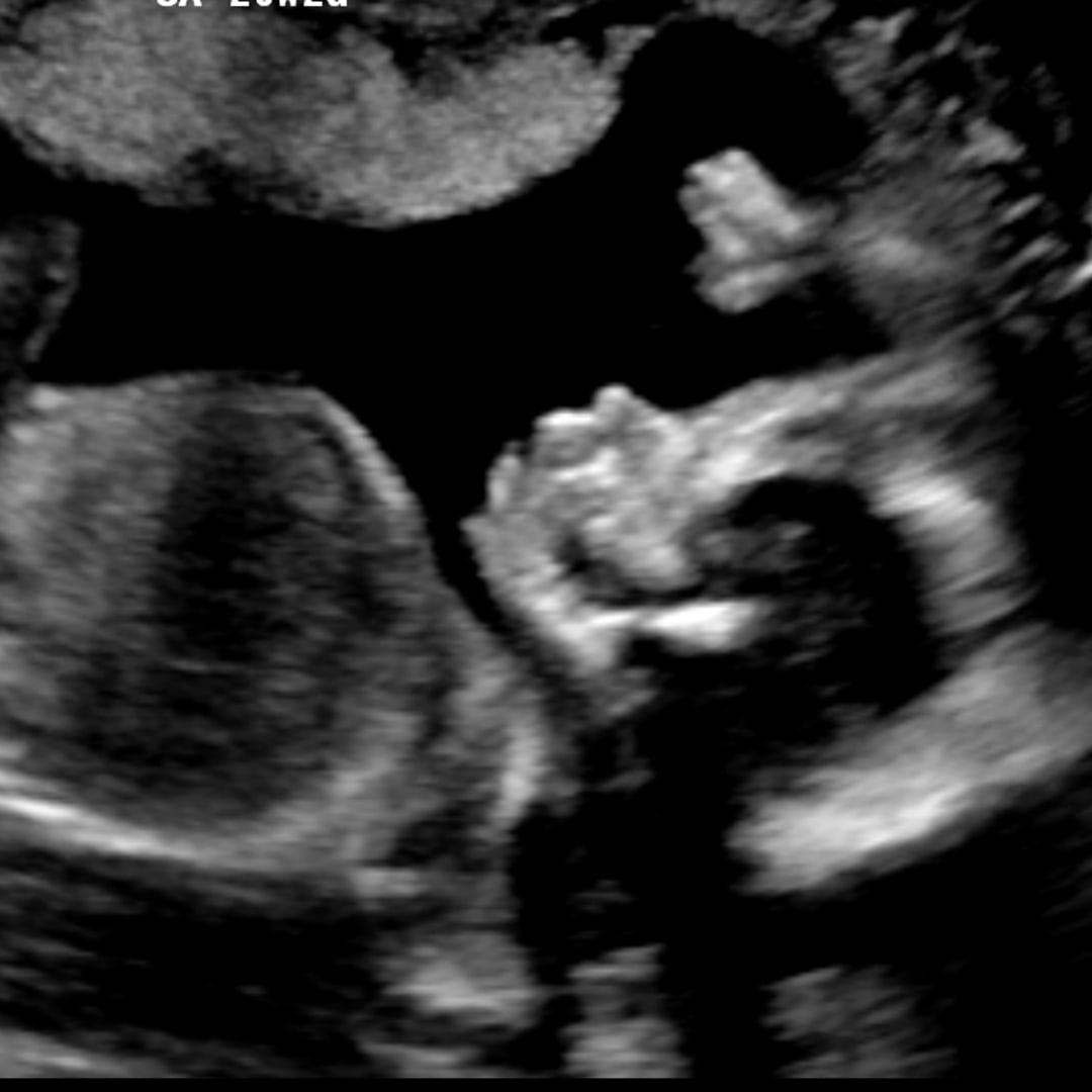 Photo shared by Alexa for their Babylist baby registry.