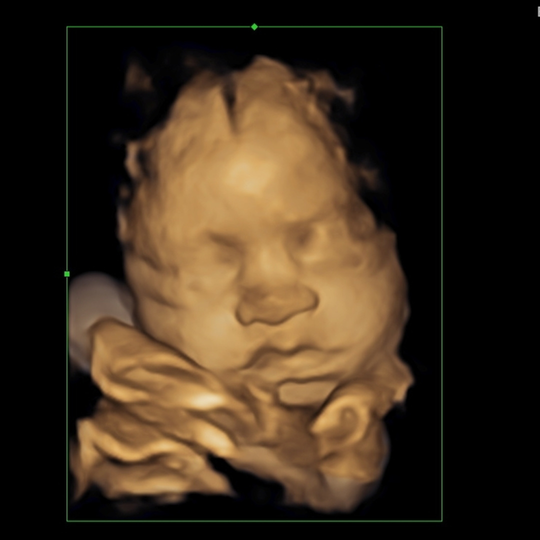 Photo shared by Angey for their Babylist baby registry.