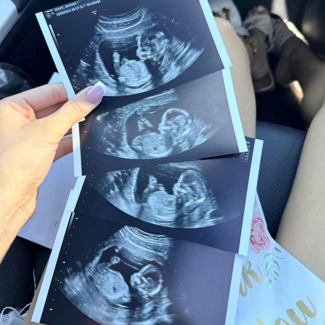 Photo shared by Arianna for their Babylist baby registry.