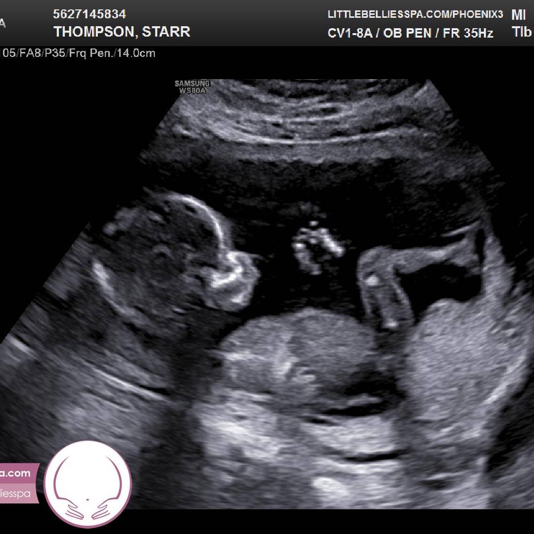 Photo shared by Starr for their Babylist baby registry.