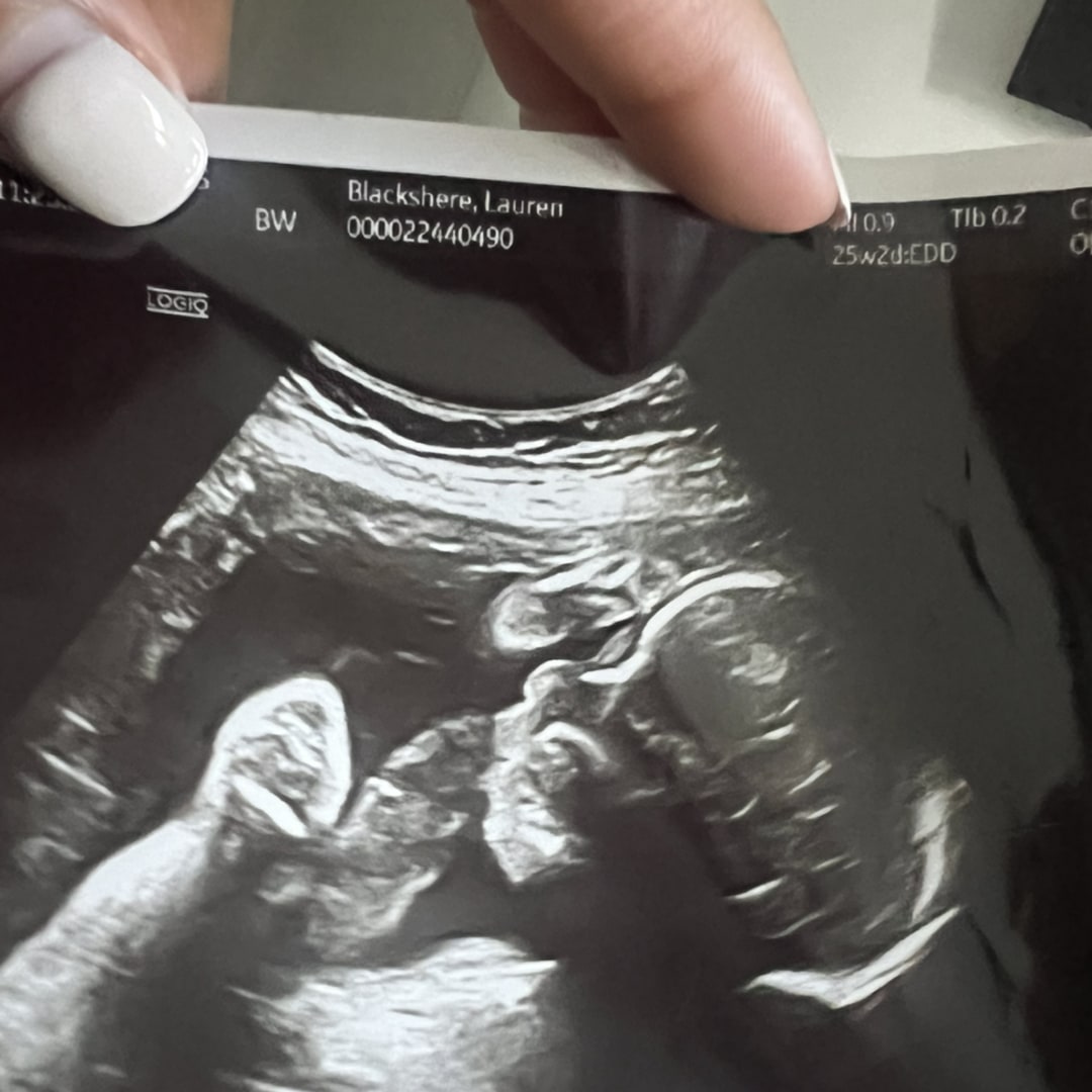 Photo shared by Lauren for their Babylist baby registry.