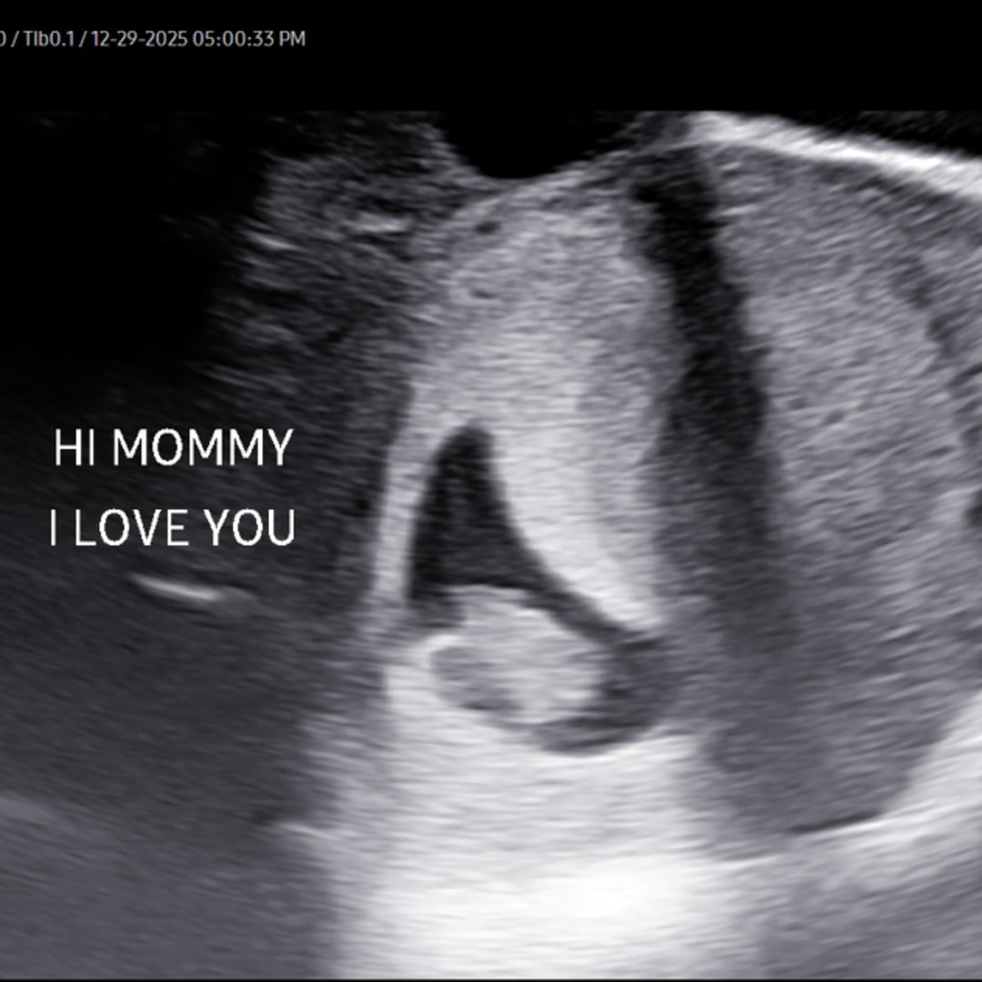 Photo shared by Courtney for their Babylist baby registry.