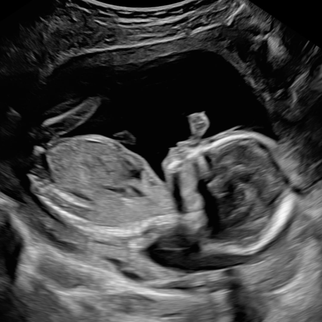 Photo shared by Dmiria for their Babylist baby registry.