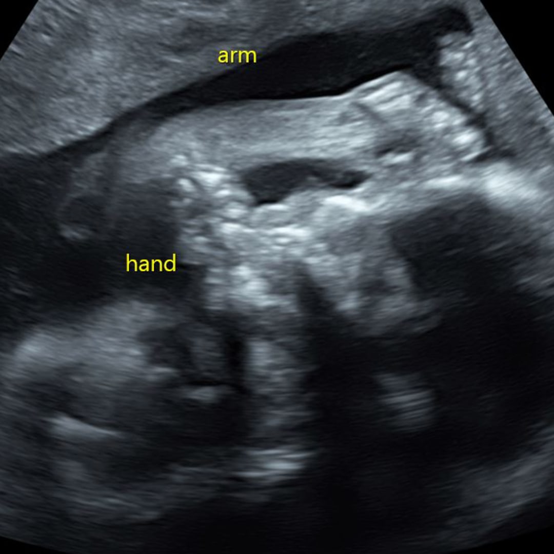 Photo shared by Tai for their Babylist baby registry.