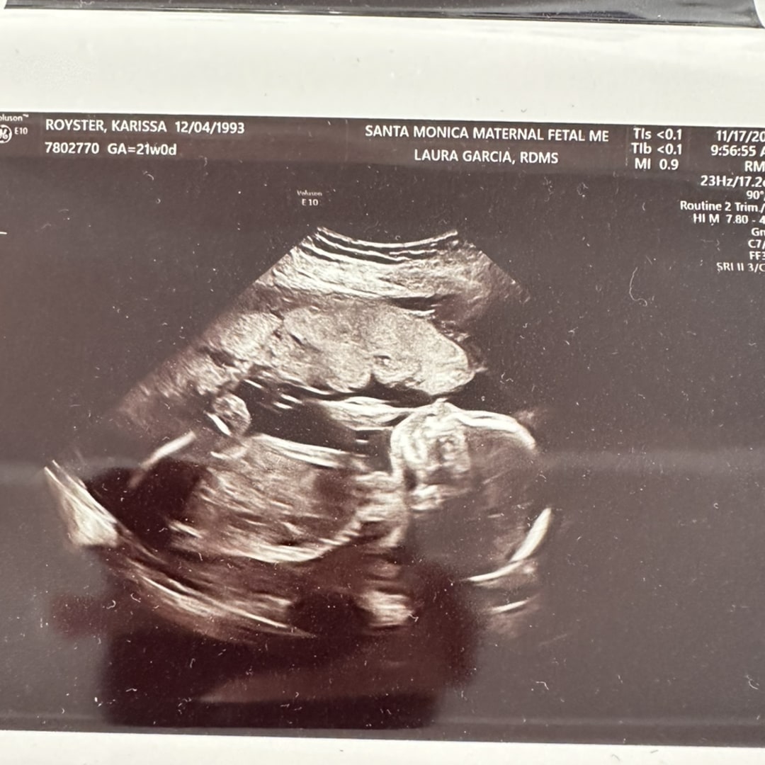 Photo shared by Karissa for their Babylist baby registry.