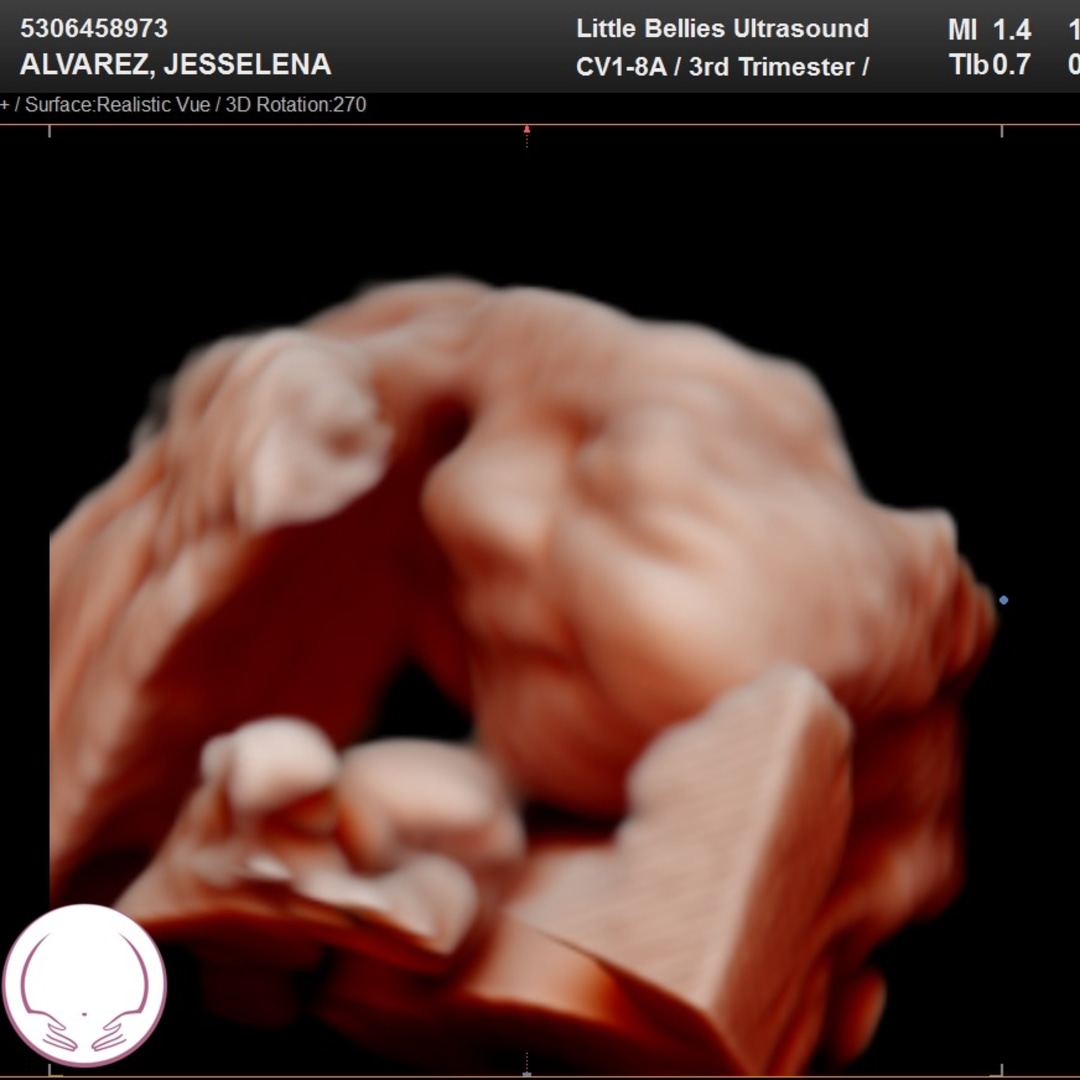 Photo shared by Jesselena for their Babylist baby registry.