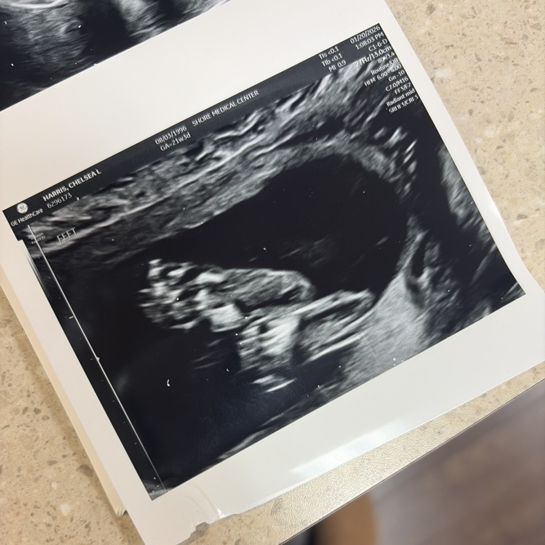 Photo shared by Chelsea for their Babylist baby registry.