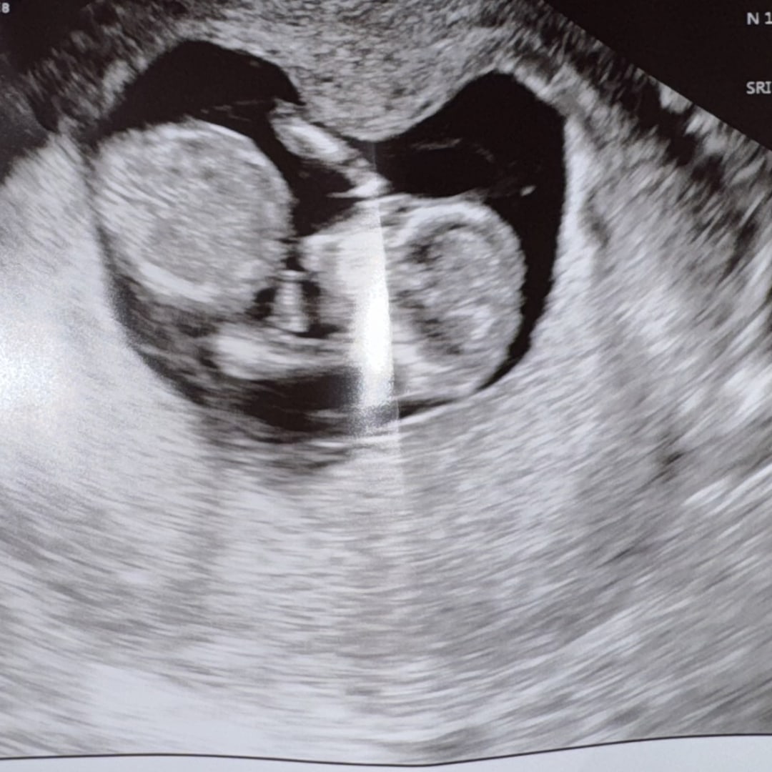 Photo shared by Ina for their Babylist baby registry.