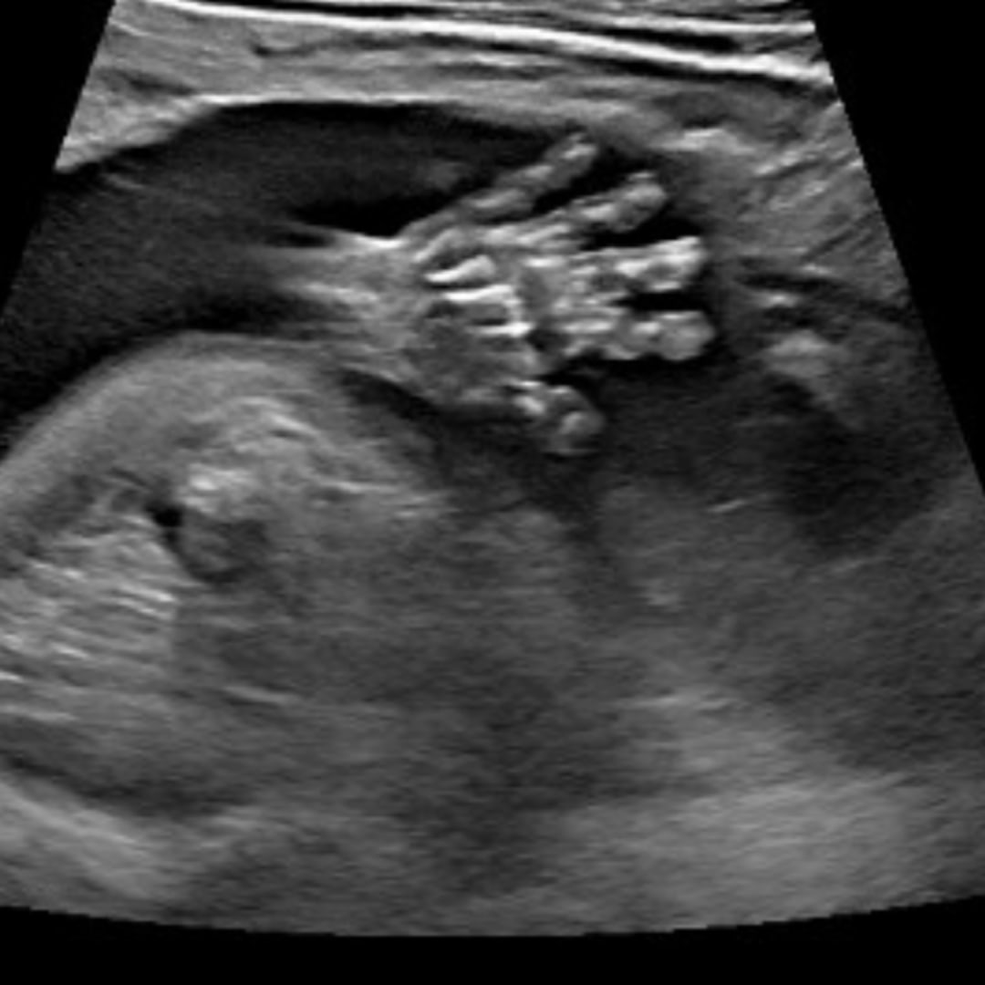 Photo shared by Olivia for their Babylist baby registry.