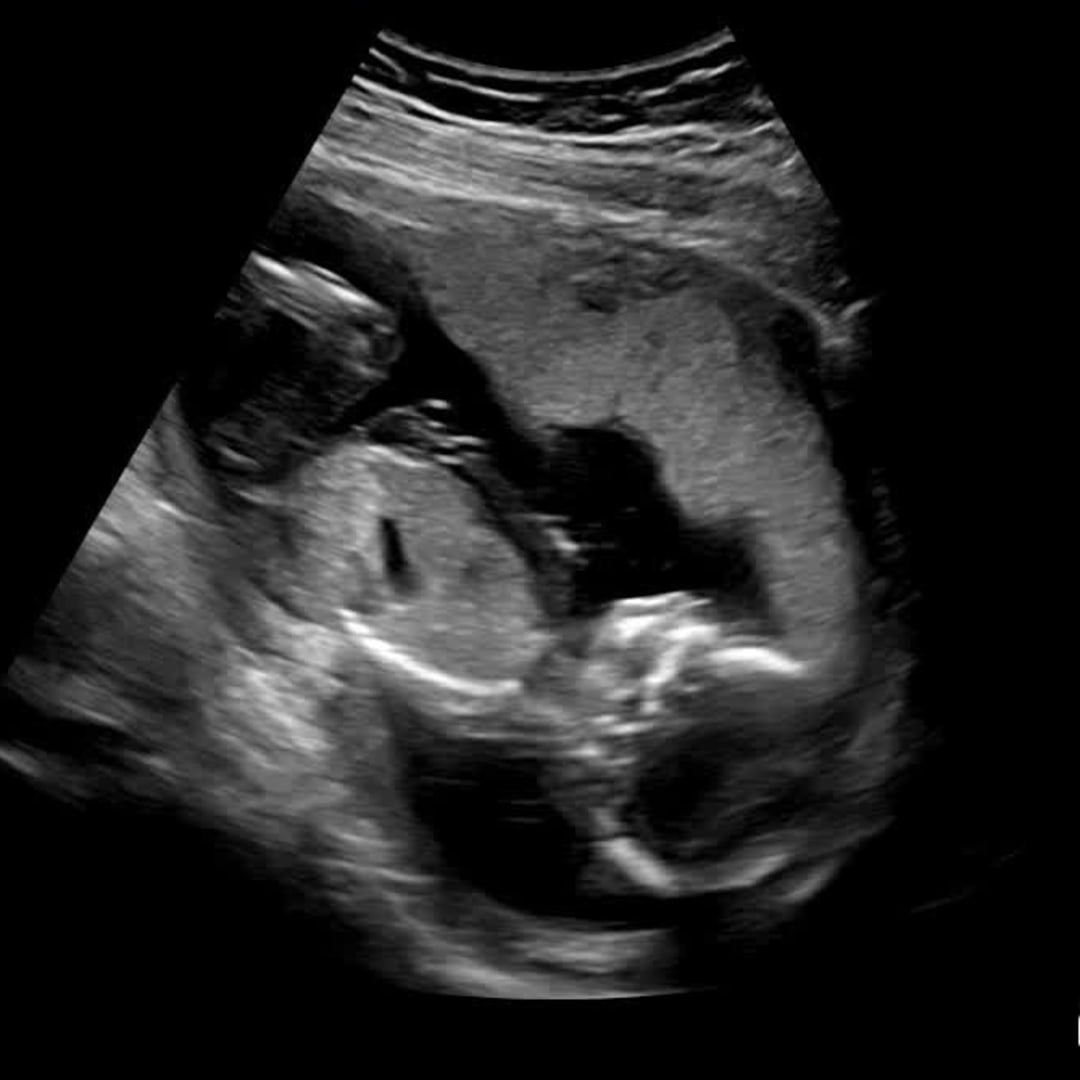 Photo shared by Rosa for their Babylist baby registry.