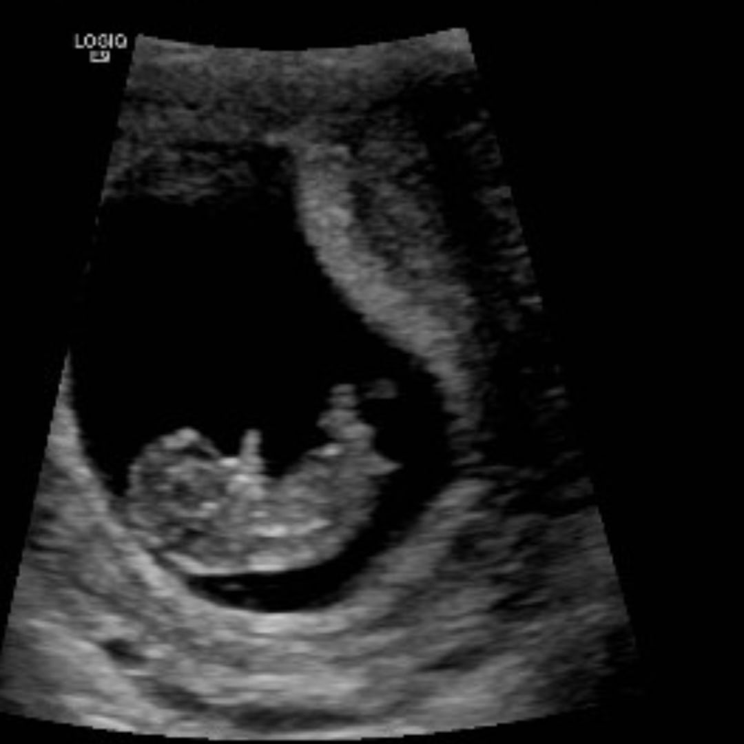 Photo shared by Kaitlyn & Nick for their Babylist baby registry.