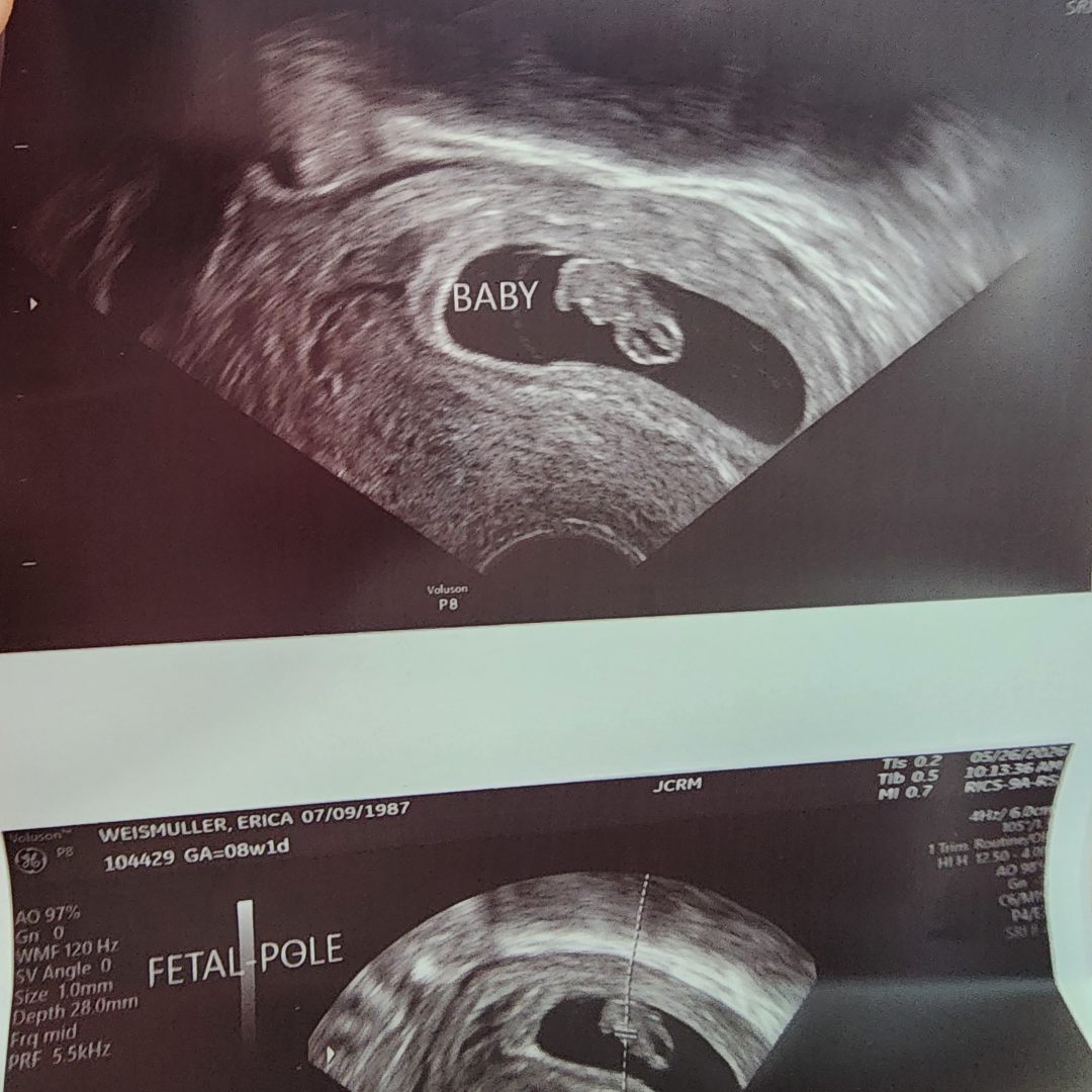 Photo shared by Erica for their Babylist baby registry.