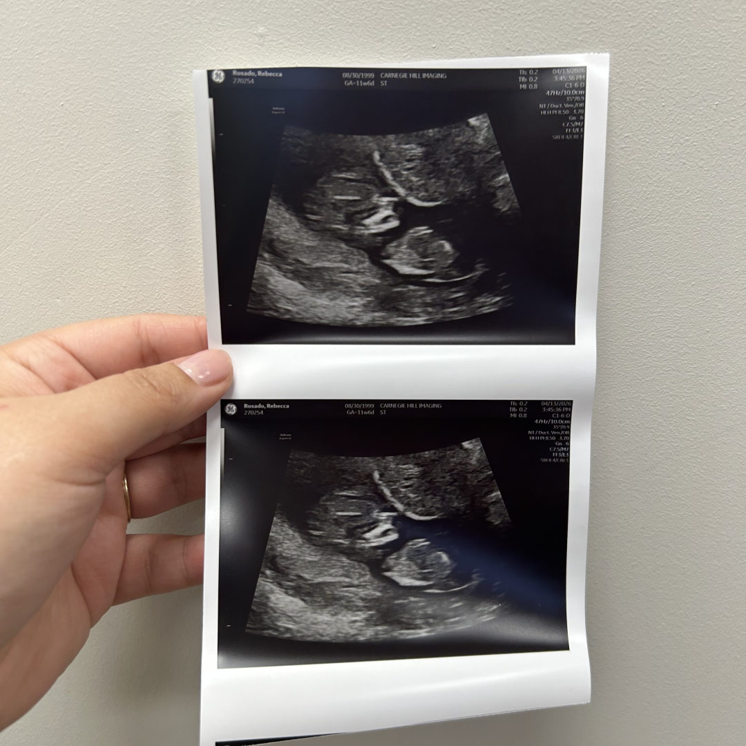 Photo shared by Rebecca for their Babylist baby registry.