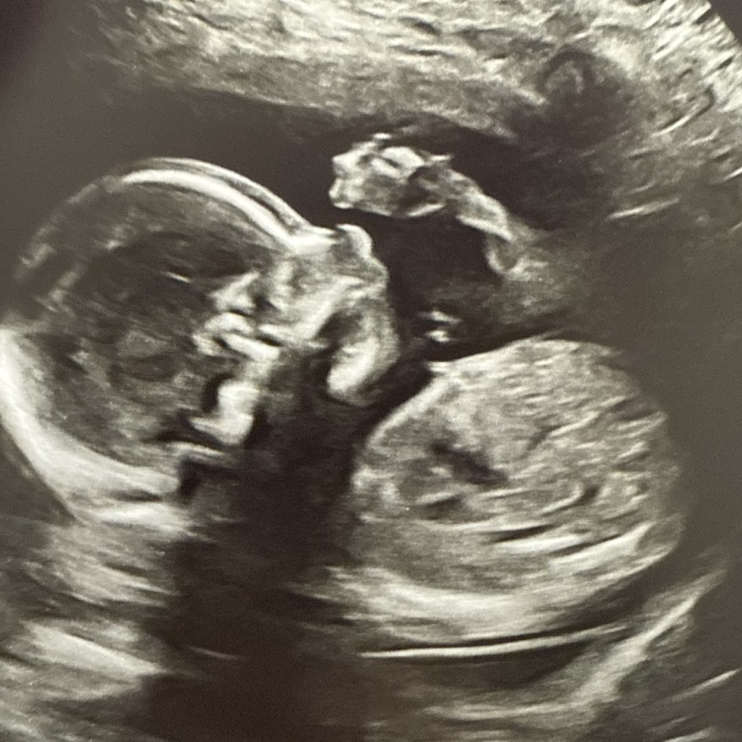 Photo shared by Frannie for their Babylist baby registry.