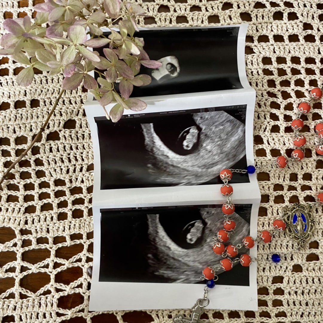 Photo shared by Lily for their Babylist baby registry.