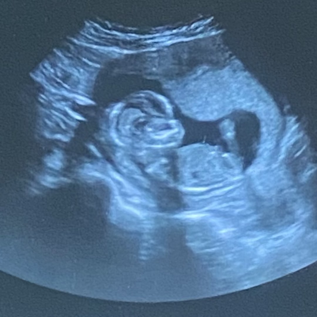 Photo shared by Donna for their Babylist baby registry.