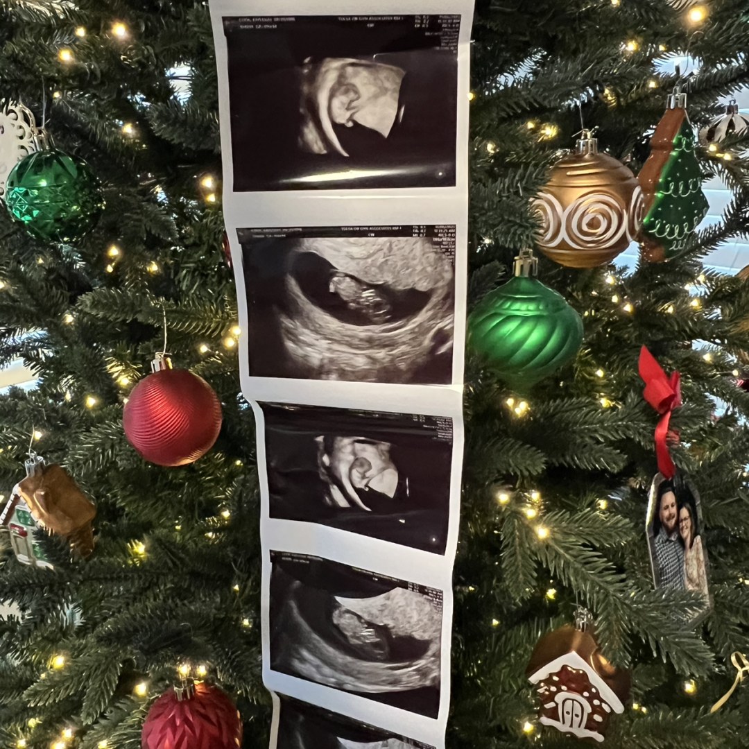 Photo shared by Kayleigh for their Babylist baby registry.