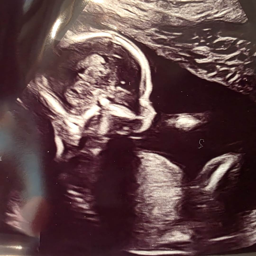 Photo shared by Rachael for their Babylist baby registry.