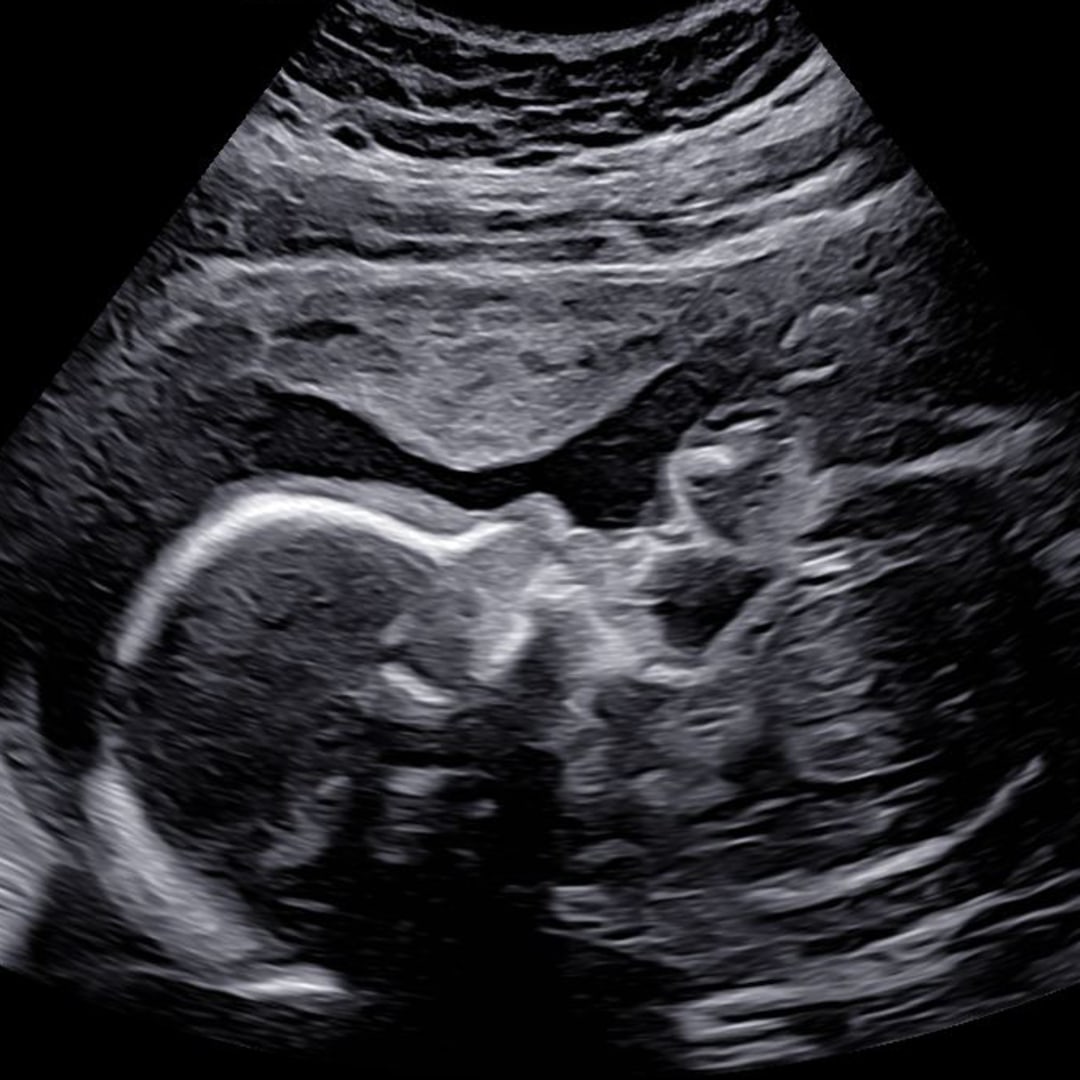 Photo shared by Lindsey for their Babylist baby registry.