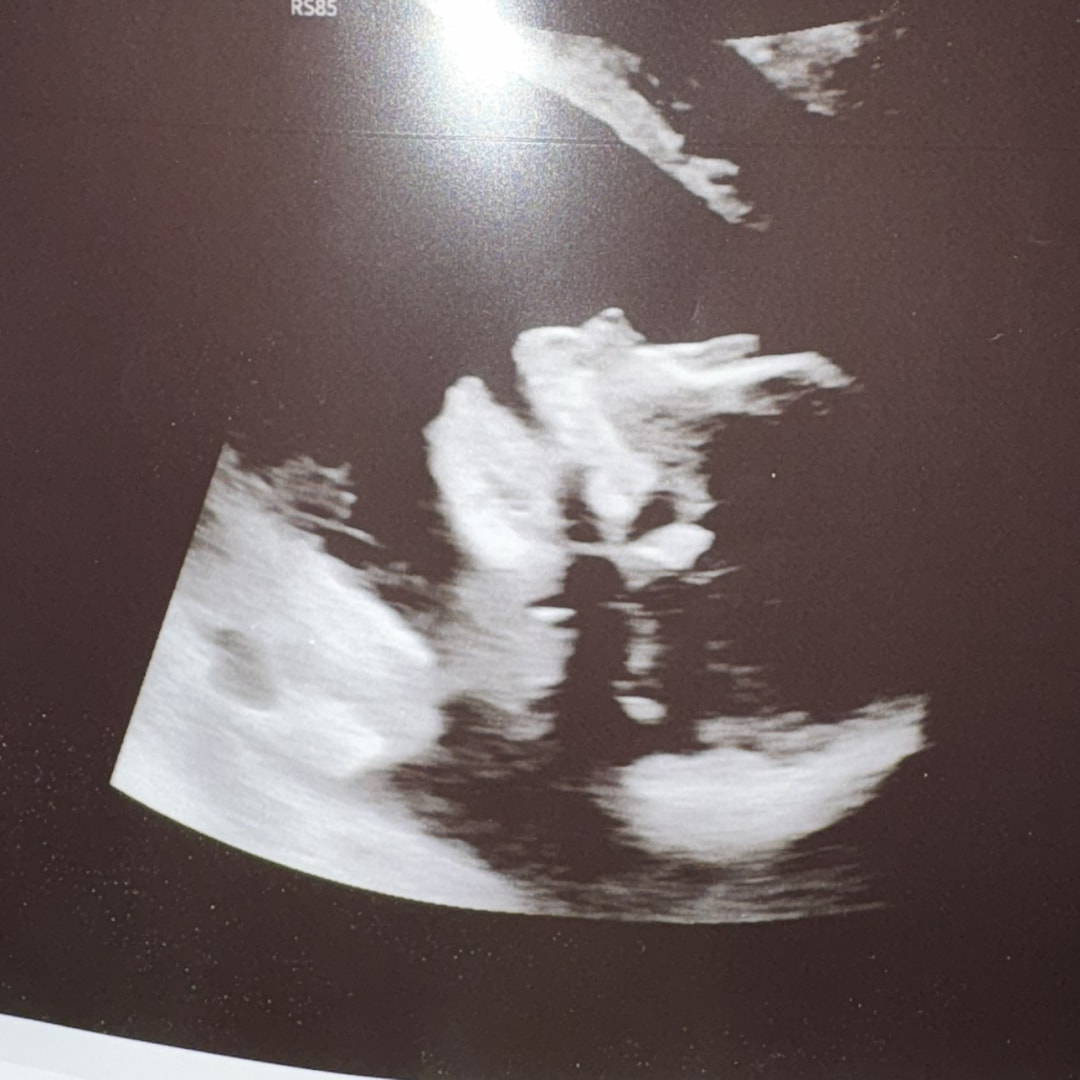 Photo shared by Haylie for their Babylist baby registry.