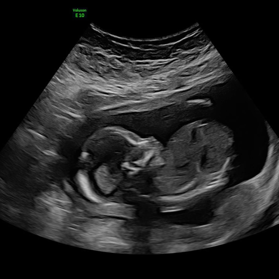Photo shared by Hannah for their Babylist baby registry.