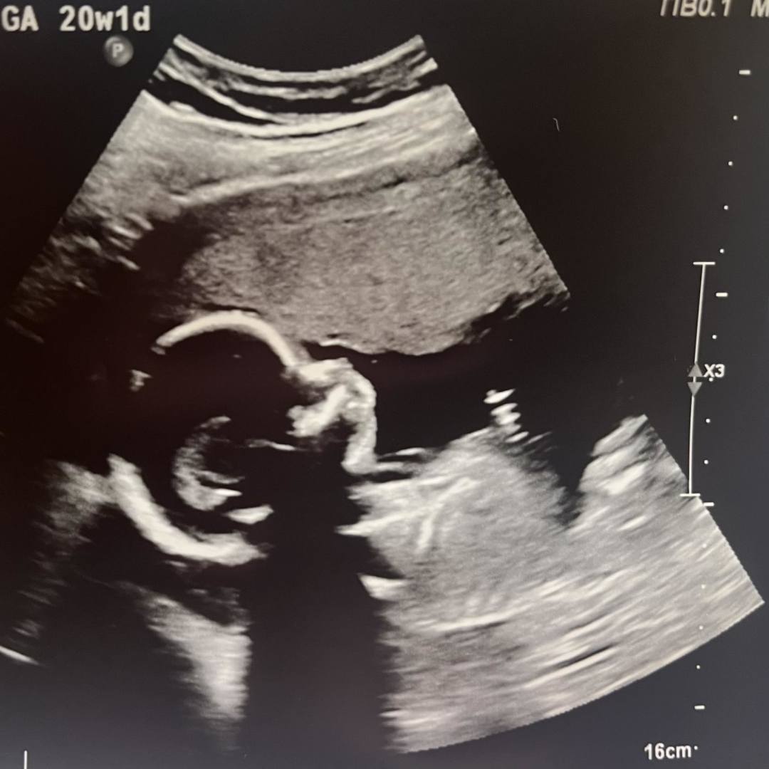 Photo shared by Jessica for their Babylist baby registry.
