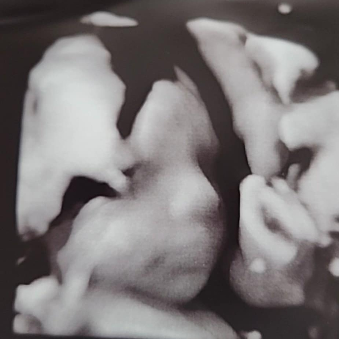 Photo shared by Emily for their Babylist baby registry.