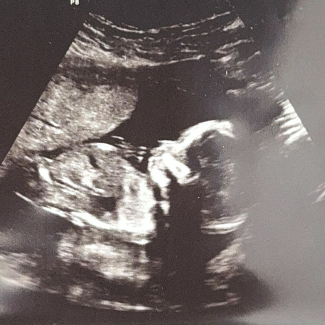 Photo shared by Carlee-Ann for their Babylist baby registry.