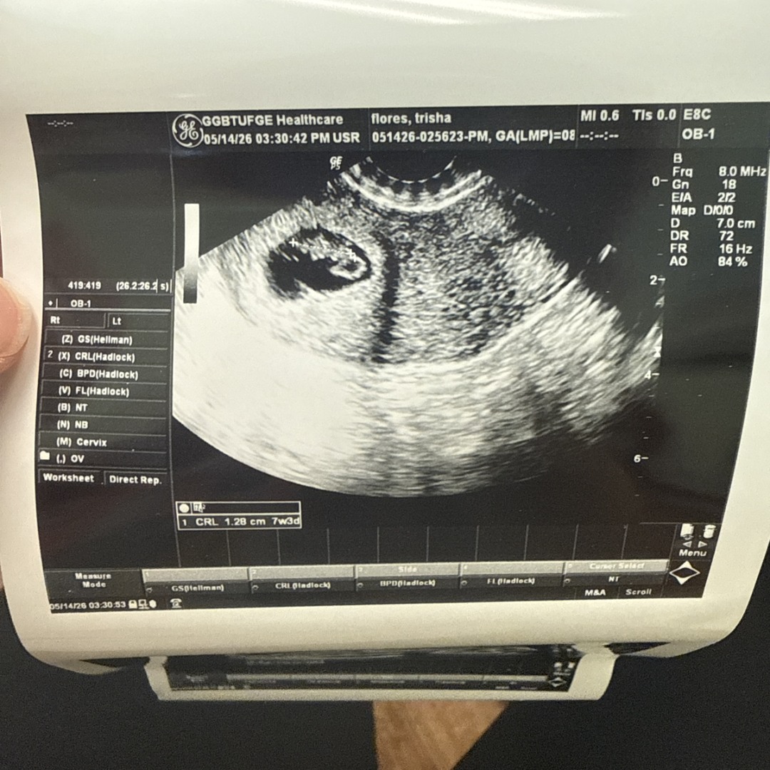 Photo shared by Trisha for their Babylist baby registry.