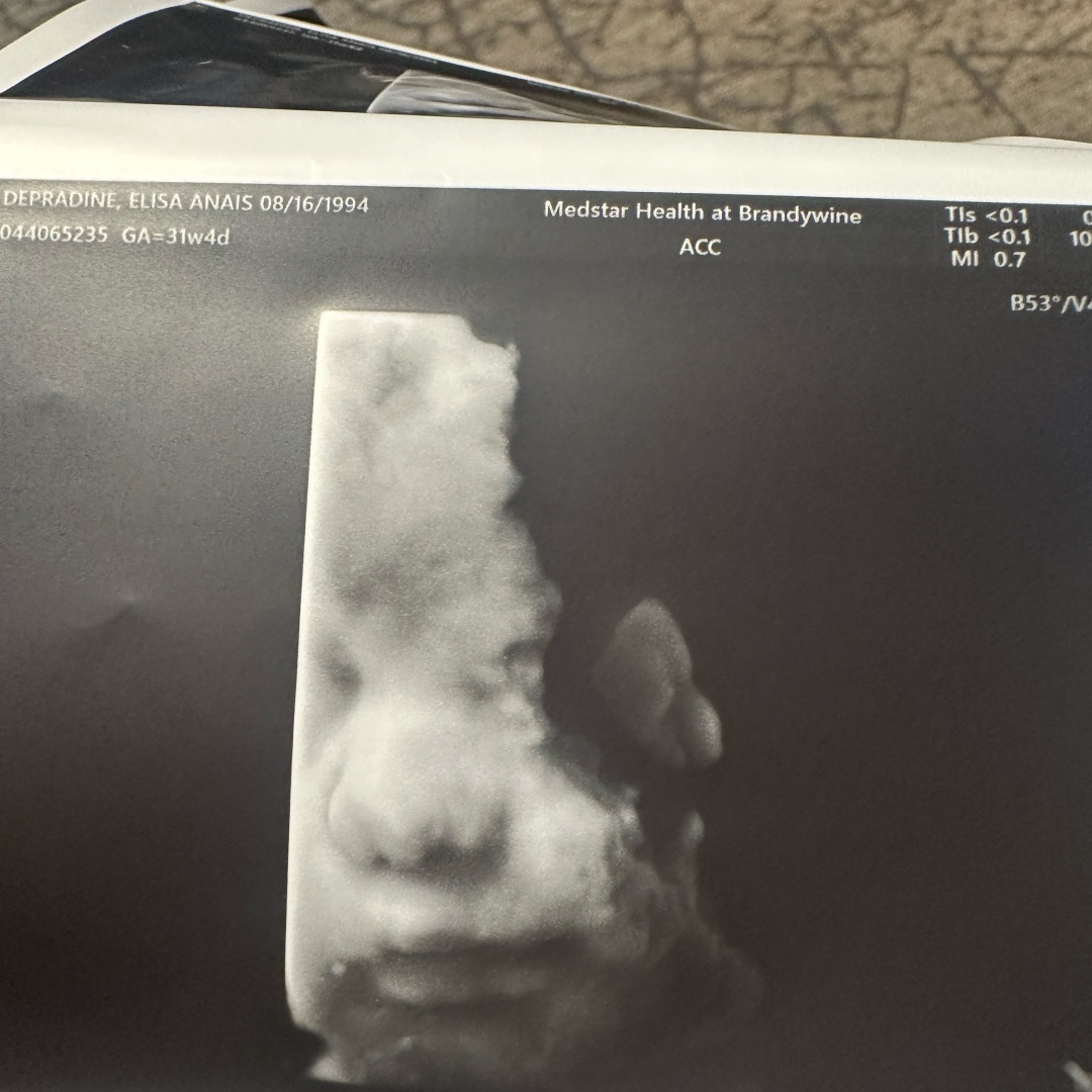 Photo shared by Elisa for their Babylist baby registry.