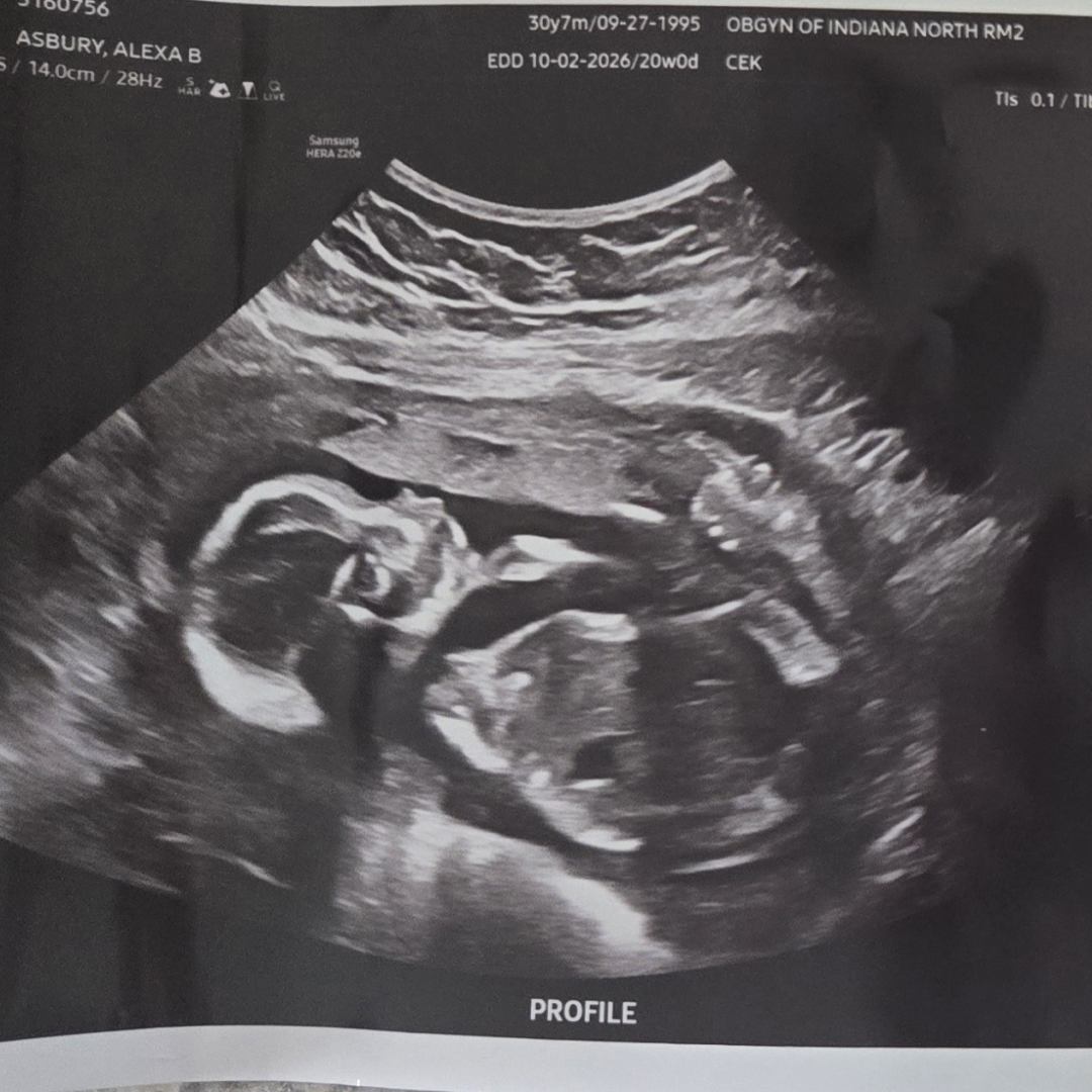Photo shared by Alexa for their Babylist baby registry.