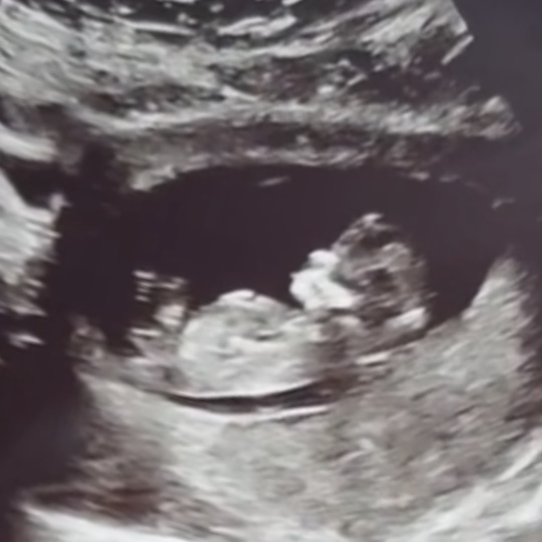 Photo shared by Alaina for their Babylist baby registry.