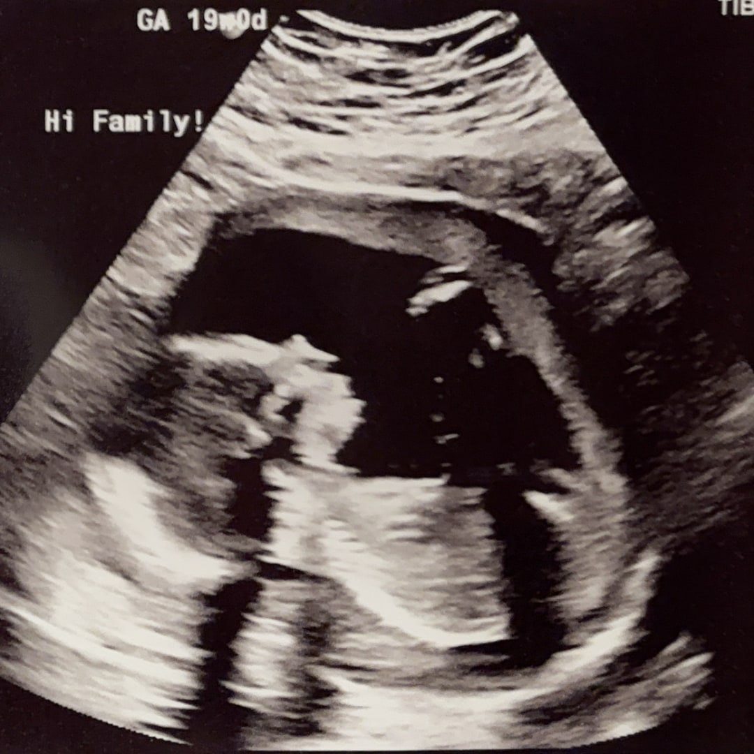 Photo shared by Aliza for their Babylist baby registry.