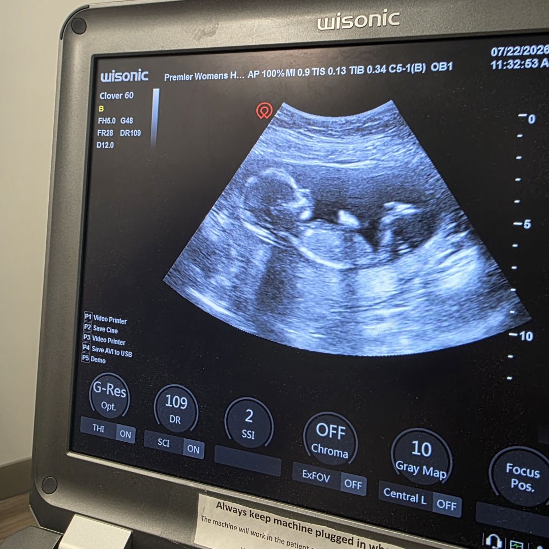 Photo shared by Chelsee for their Babylist baby registry.