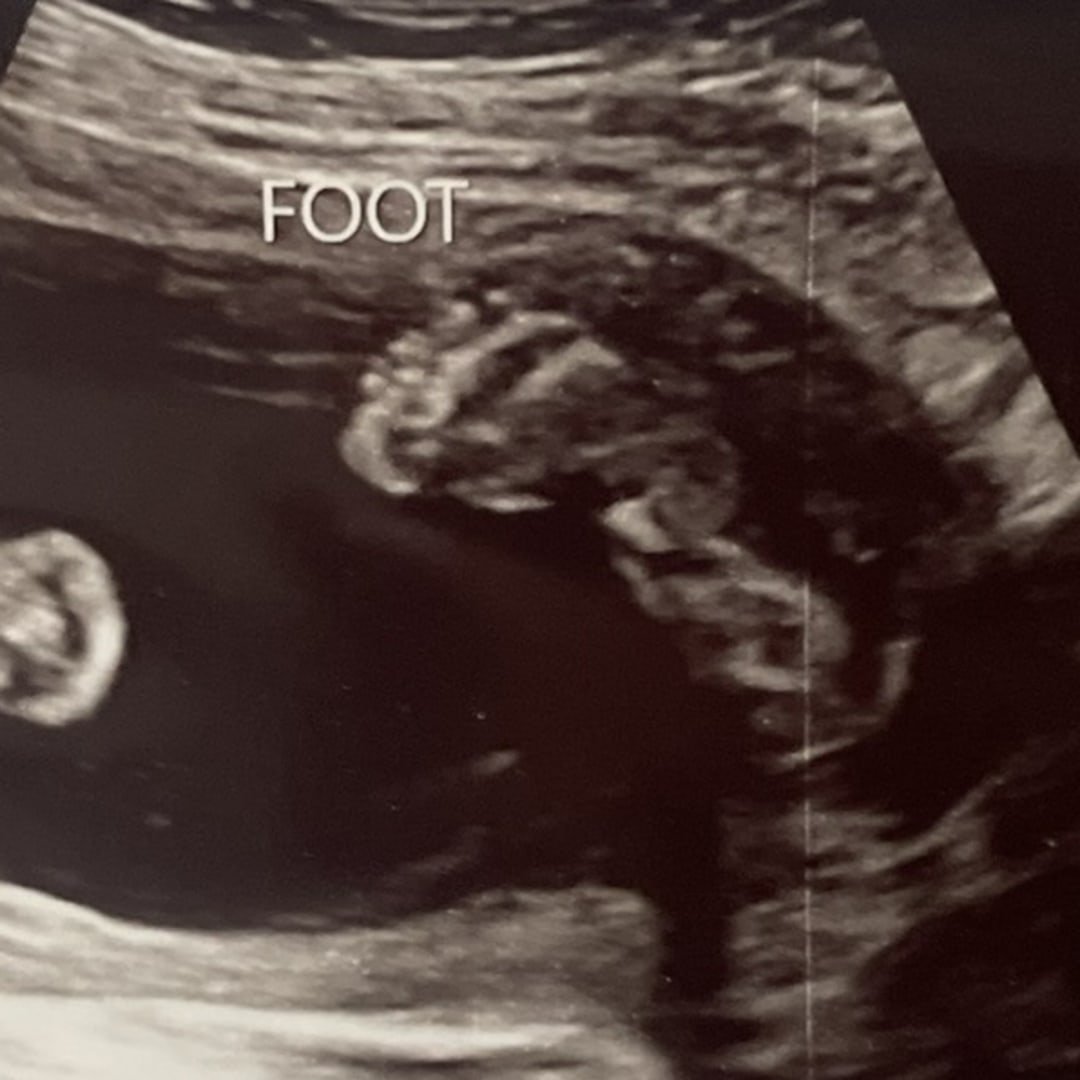 Photo shared by Isabella for their Babylist baby registry.