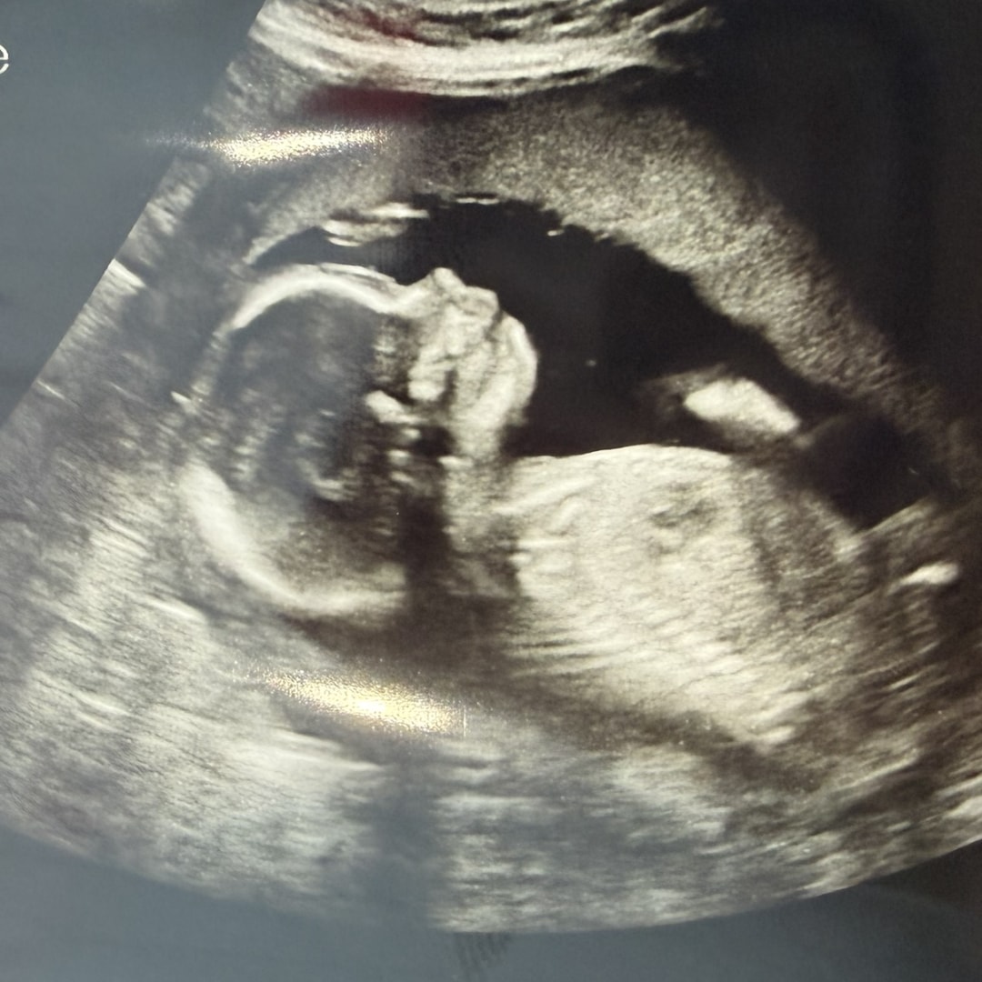 Photo shared by Madison for their Babylist baby registry.