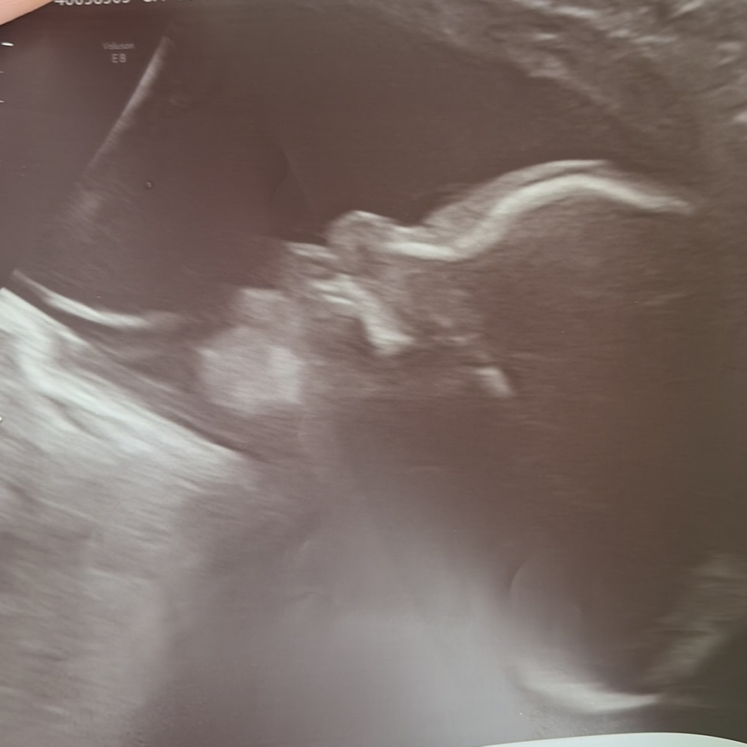 Photo shared by Corinna for their Babylist baby registry.