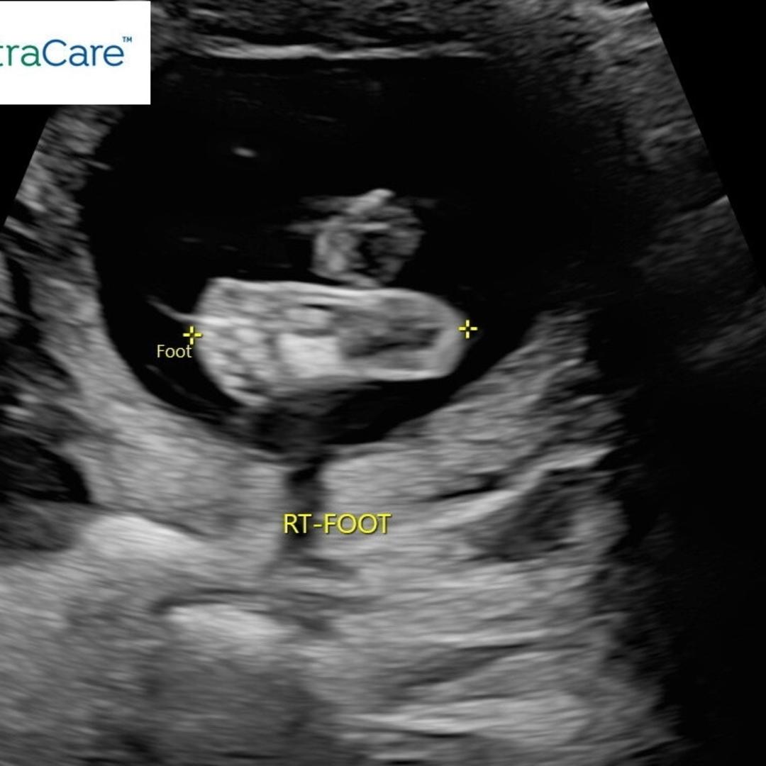 Photo shared by Melissa for their Babylist baby registry.