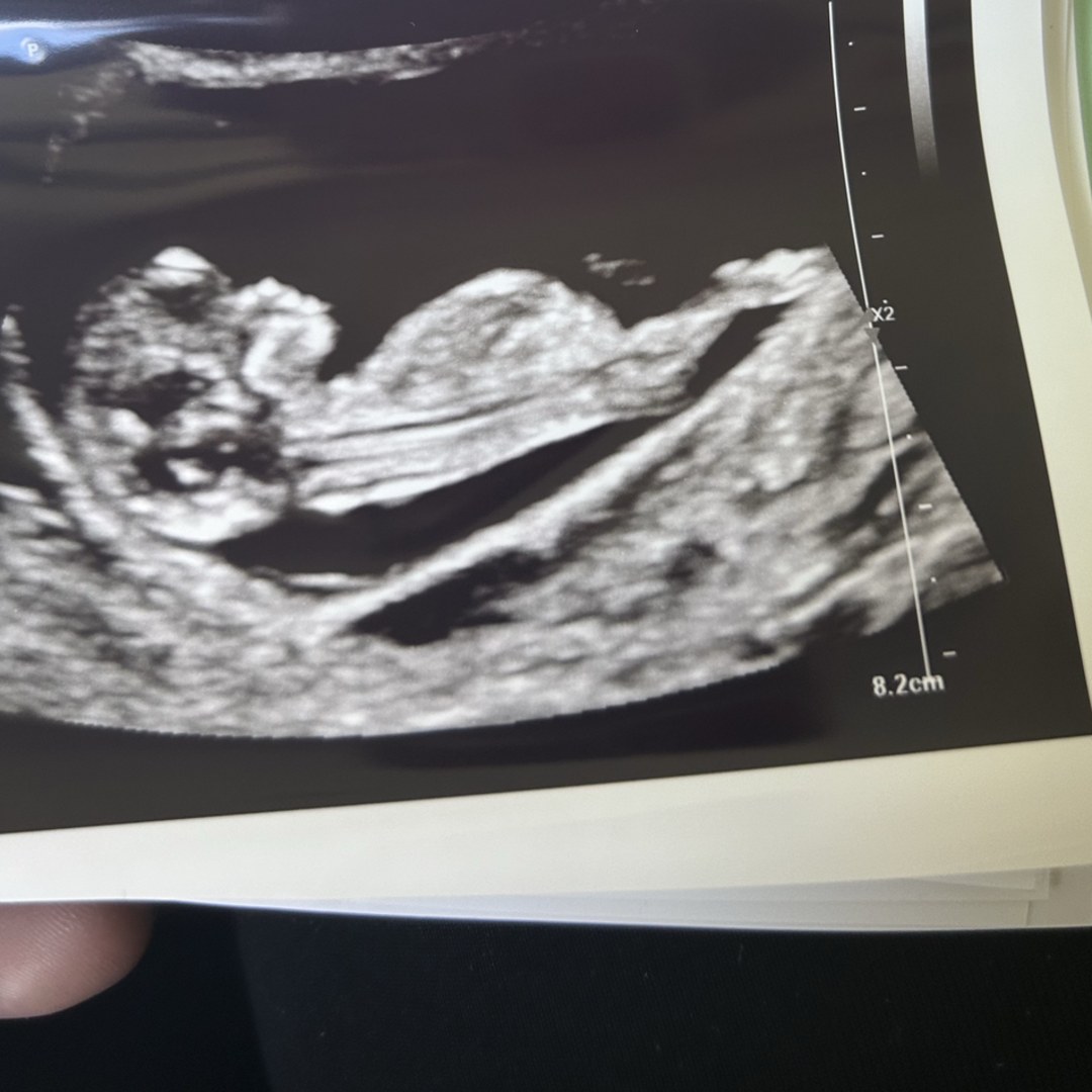 Photo shared by Jasmine for their Babylist baby registry.