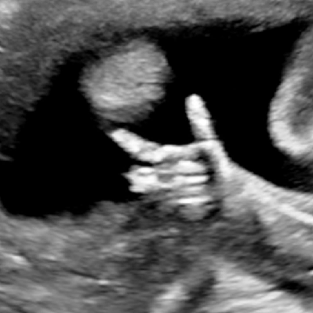 Photo shared by Bianca for their Babylist baby registry.