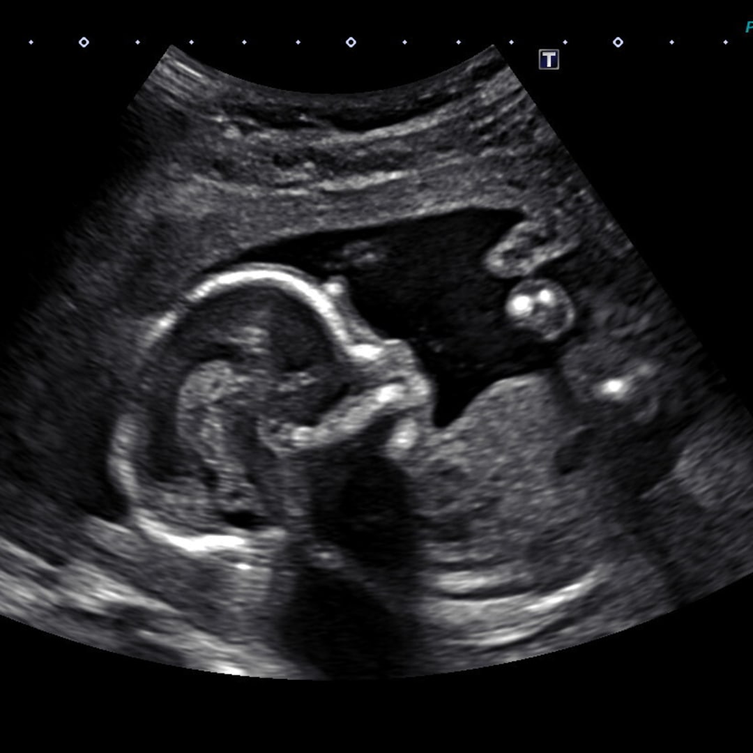 Photo shared by Sophia for their Babylist baby registry.