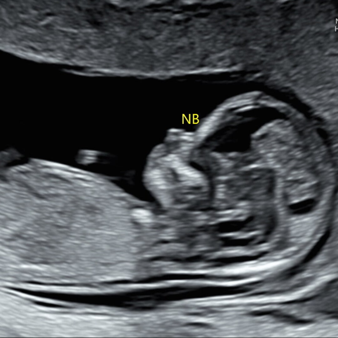 Photo shared by Allenschka for their Babylist baby registry.