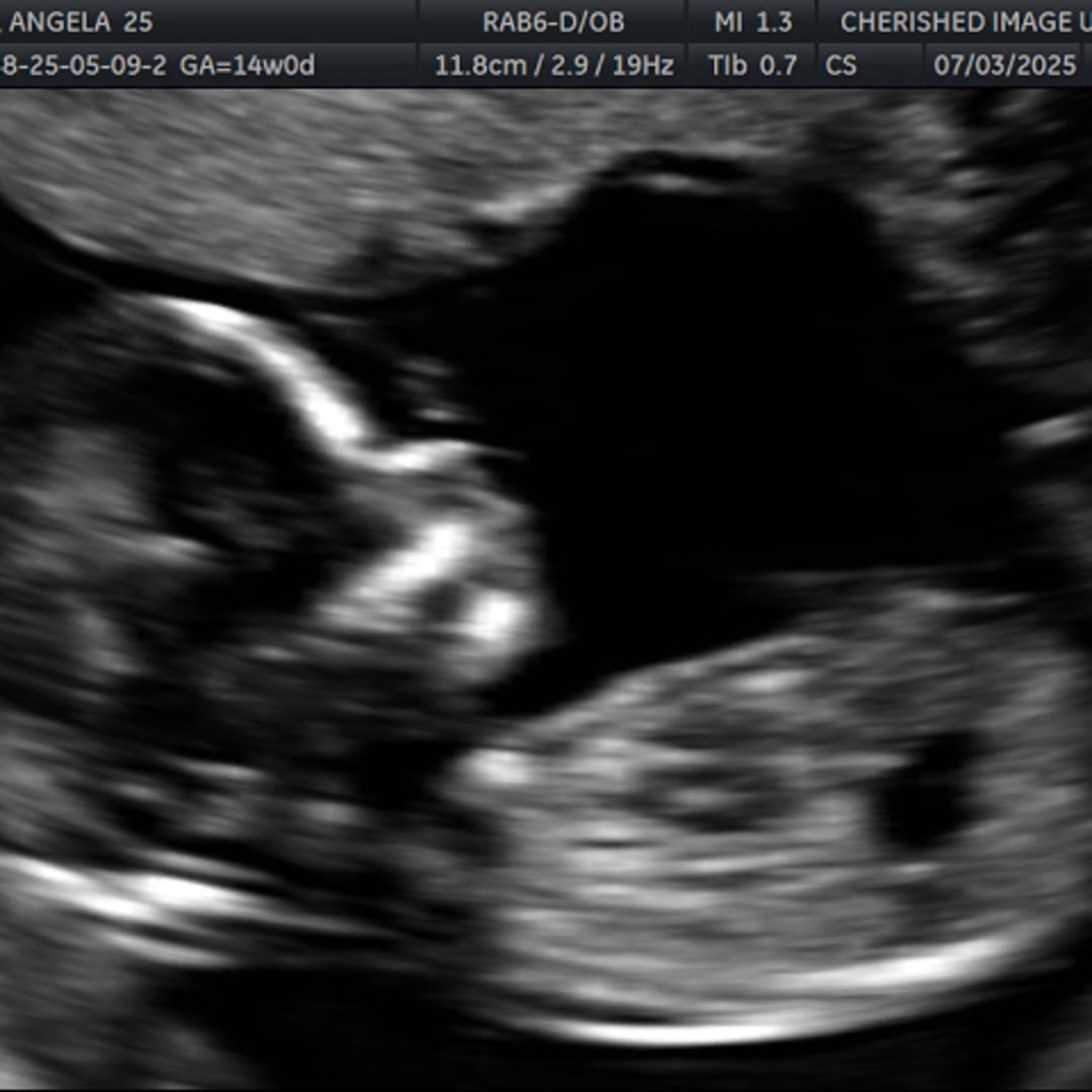 Photo shared by Angela for their Babylist baby registry.