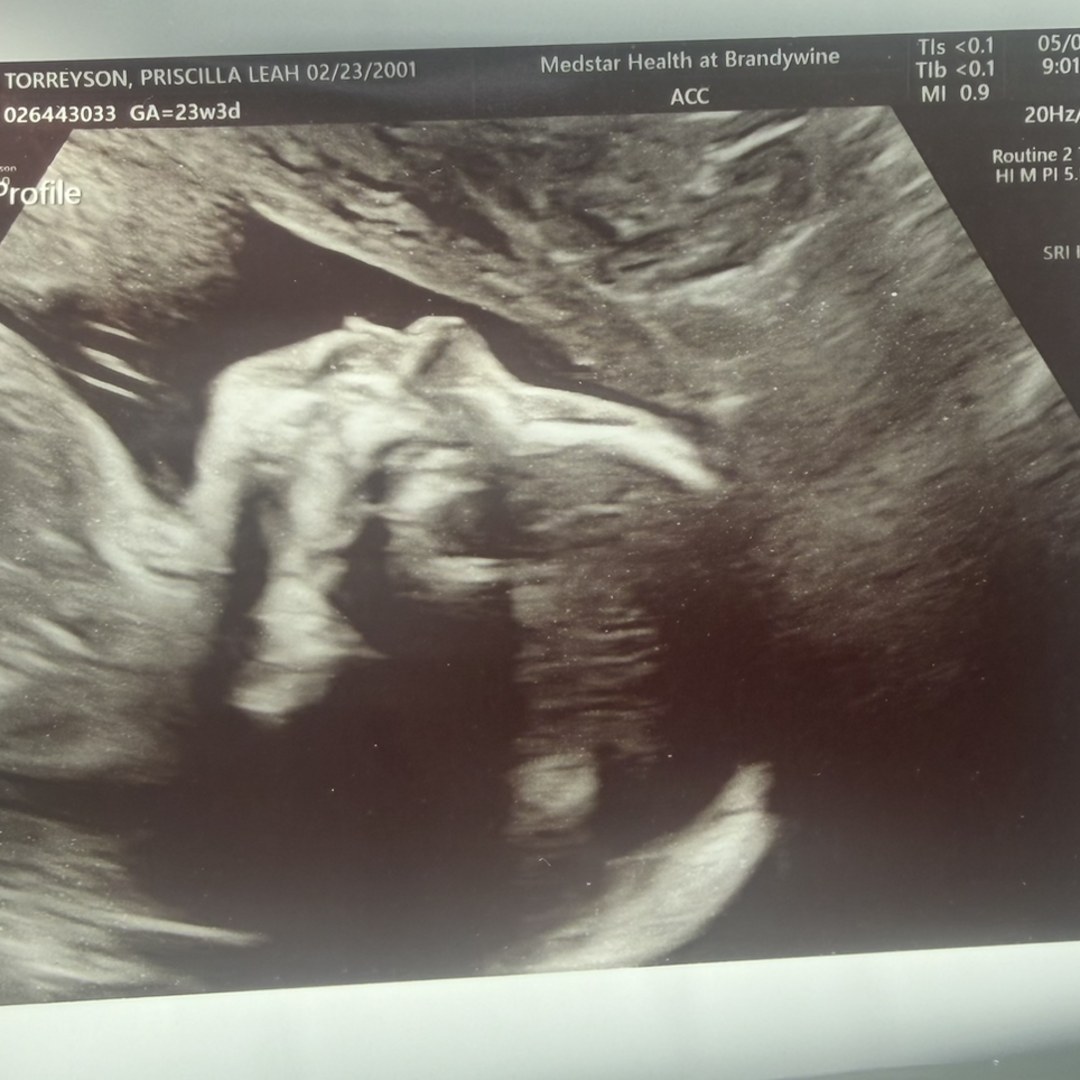 Photo shared by Priscilla for their Babylist baby registry.