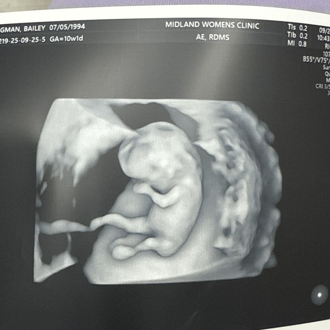 Photo shared by Bailey for their Babylist baby registry.