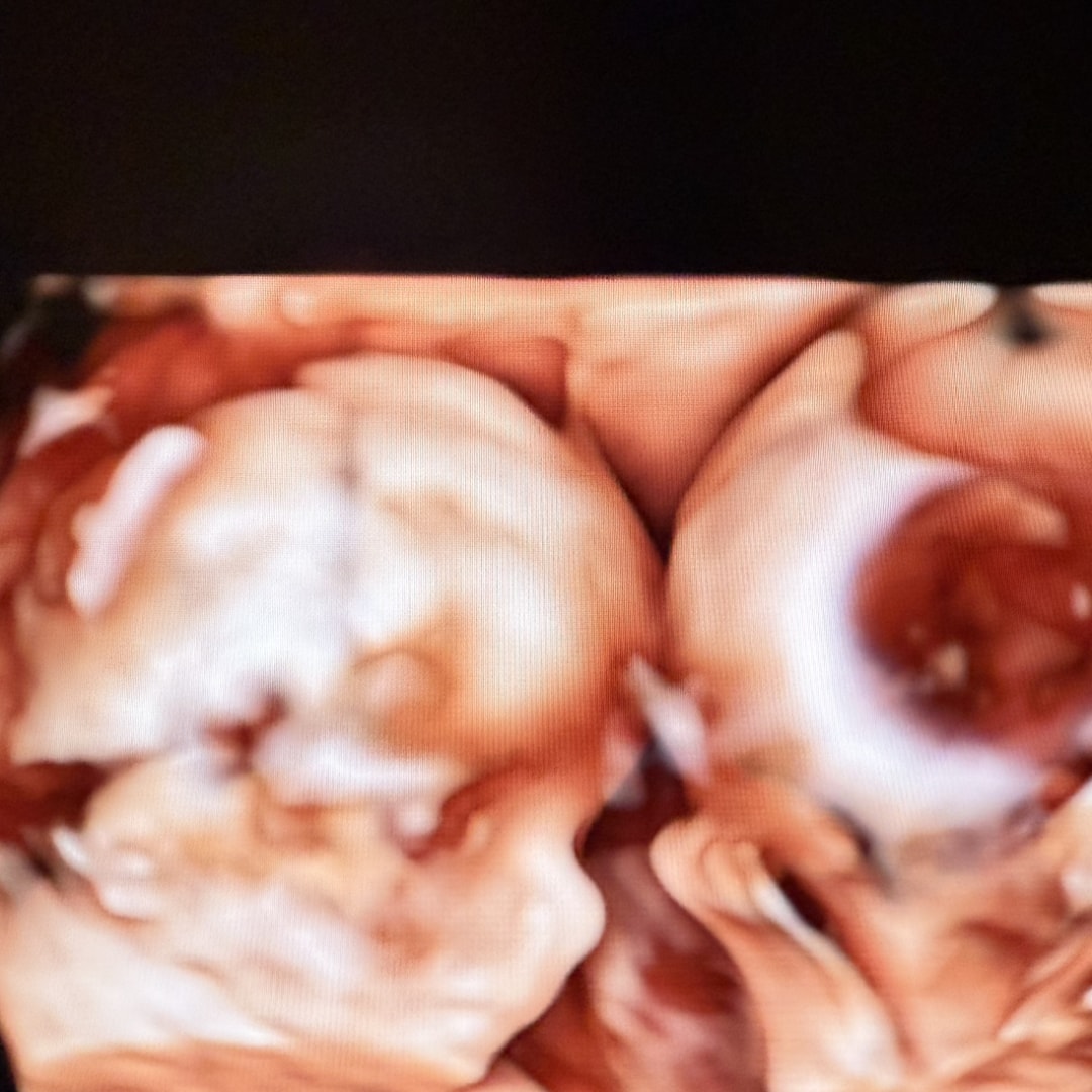Photo shared by Christianne for their Babylist baby registry.